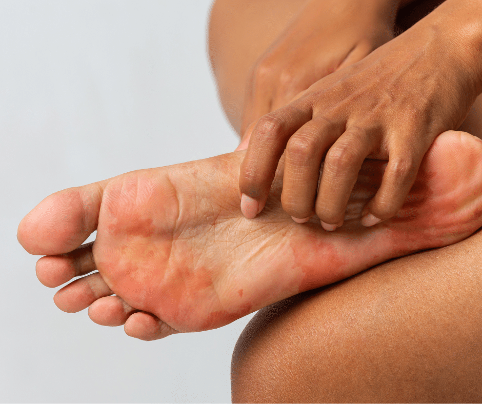 red itchy foot