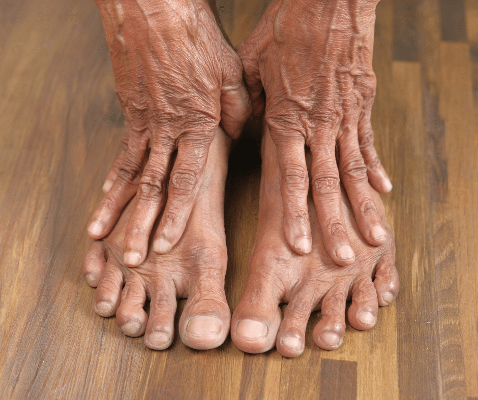elderly feet