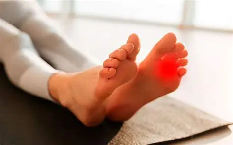 Two bare feet with the forefoot highlighted red on the left foot, illustrating the ball-of-foot nerve pain of a Morton's neuroma treated at CarePlus in Bellevue.