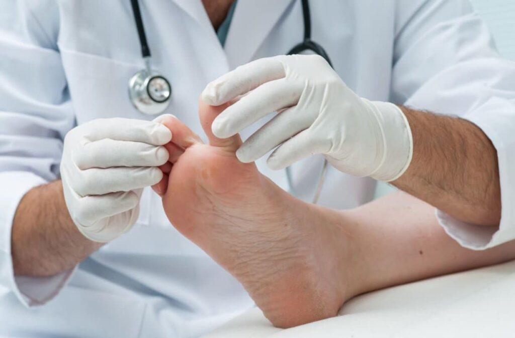 Doctor is checking a patient's toes for medical issues